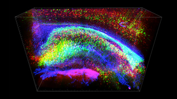 Vedere attraverso il cervello