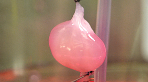 Il rene costruito in laboratorio