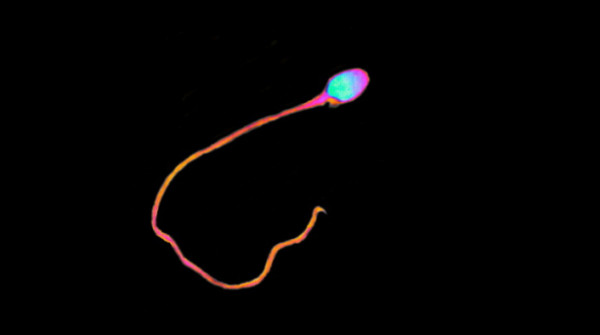 Spermbot