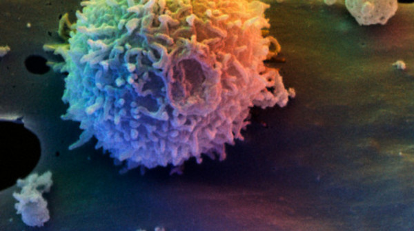 Immunoterapia del cancro